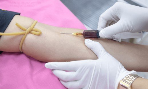 PRP Injections