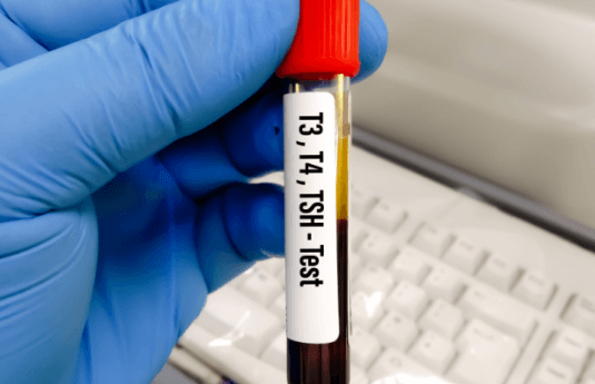 Thyroid Function Test