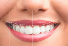 Curating Your Perfect Smile: The Intersection of Aesthetics and Health