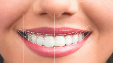 Curating Your Perfect Smile: The Intersection of Aesthetics and Health