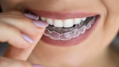 4 Signs Your Nightguard Might Need Replacement