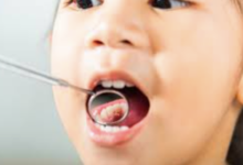 Why Regular Checkups Are The Best Protection Against Cavities