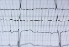 hyper node identifies stellar pulse