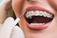 Braces To Aligners: Exploring Treatment Options With An Orthodontist In Sydney