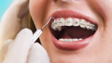 Braces To Aligners: Exploring Treatment Options With An Orthodontist In Sydney