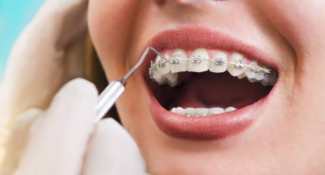 Braces To Aligners: Exploring Treatment Options With An Orthodontist In Sydney